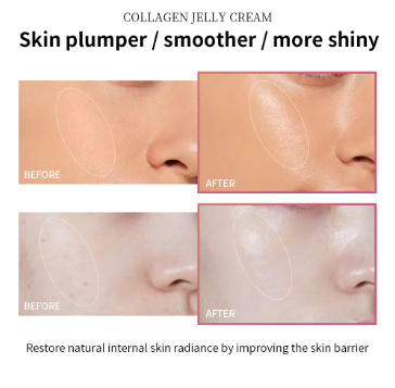 Collagen Jelly Cream – Hydrating & Firming Anti-Aging Moisturizer